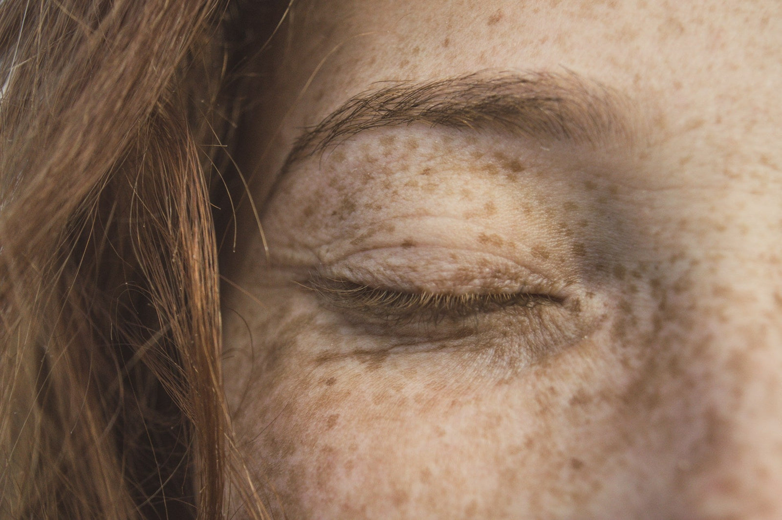 A moment of stillness: freckled skin and closed eyes reflect the quiet impact of stress on the skin — echoing Exoceuticals®’ science-meets-empathy approach to emotional skincare.