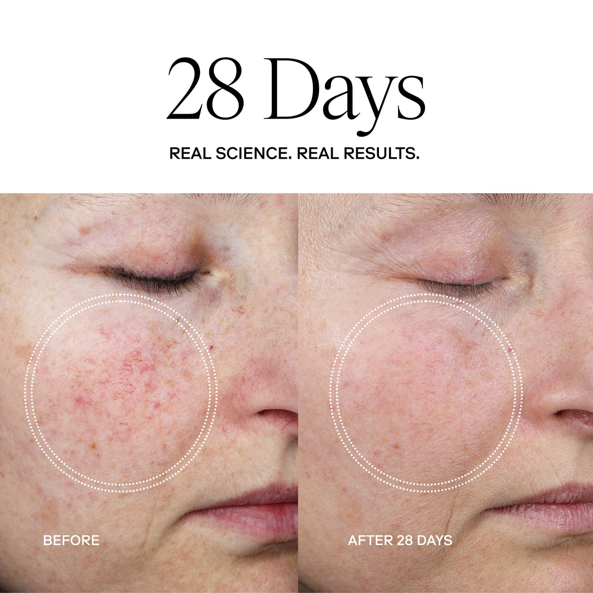EXO PLUS® Anti-Aging Cream