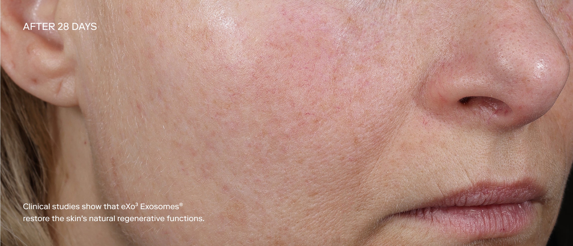 Exoceuticals