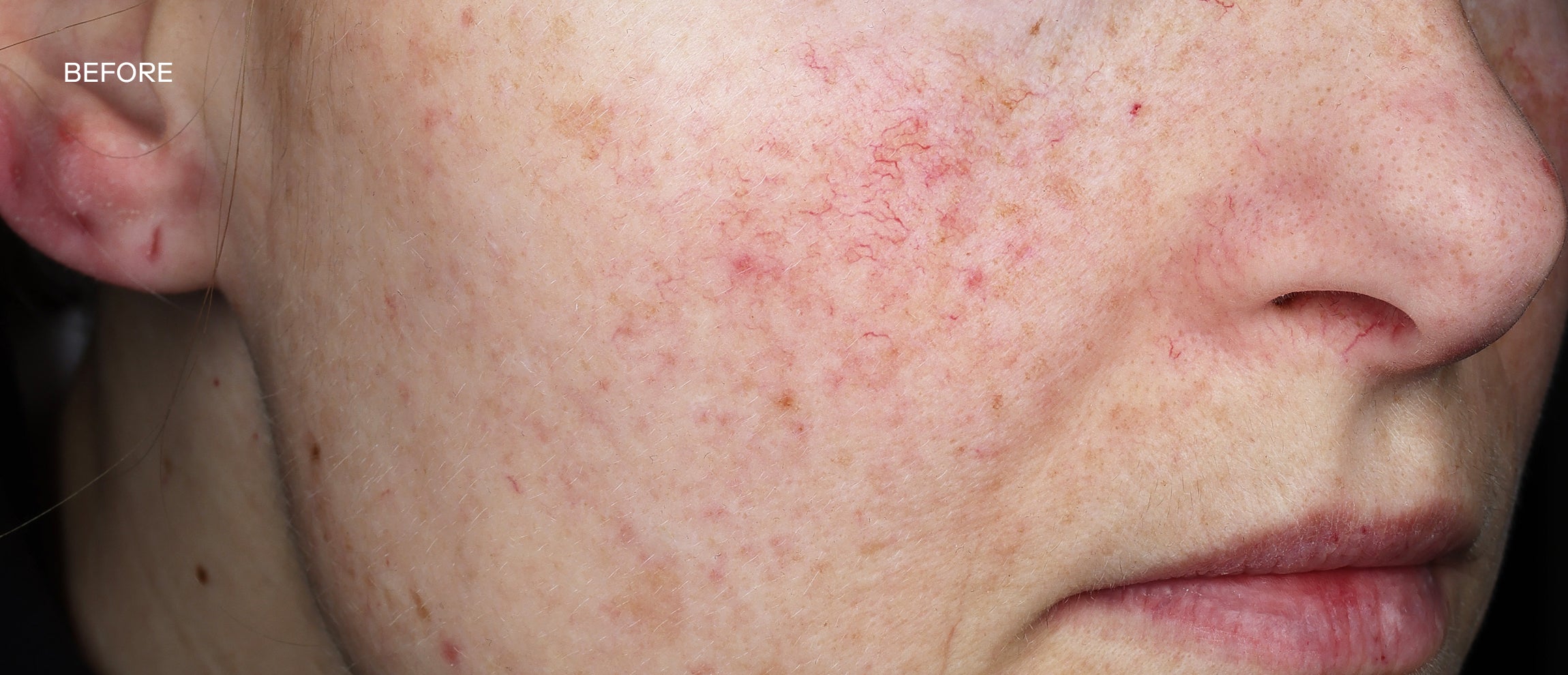 Exoceuticals
