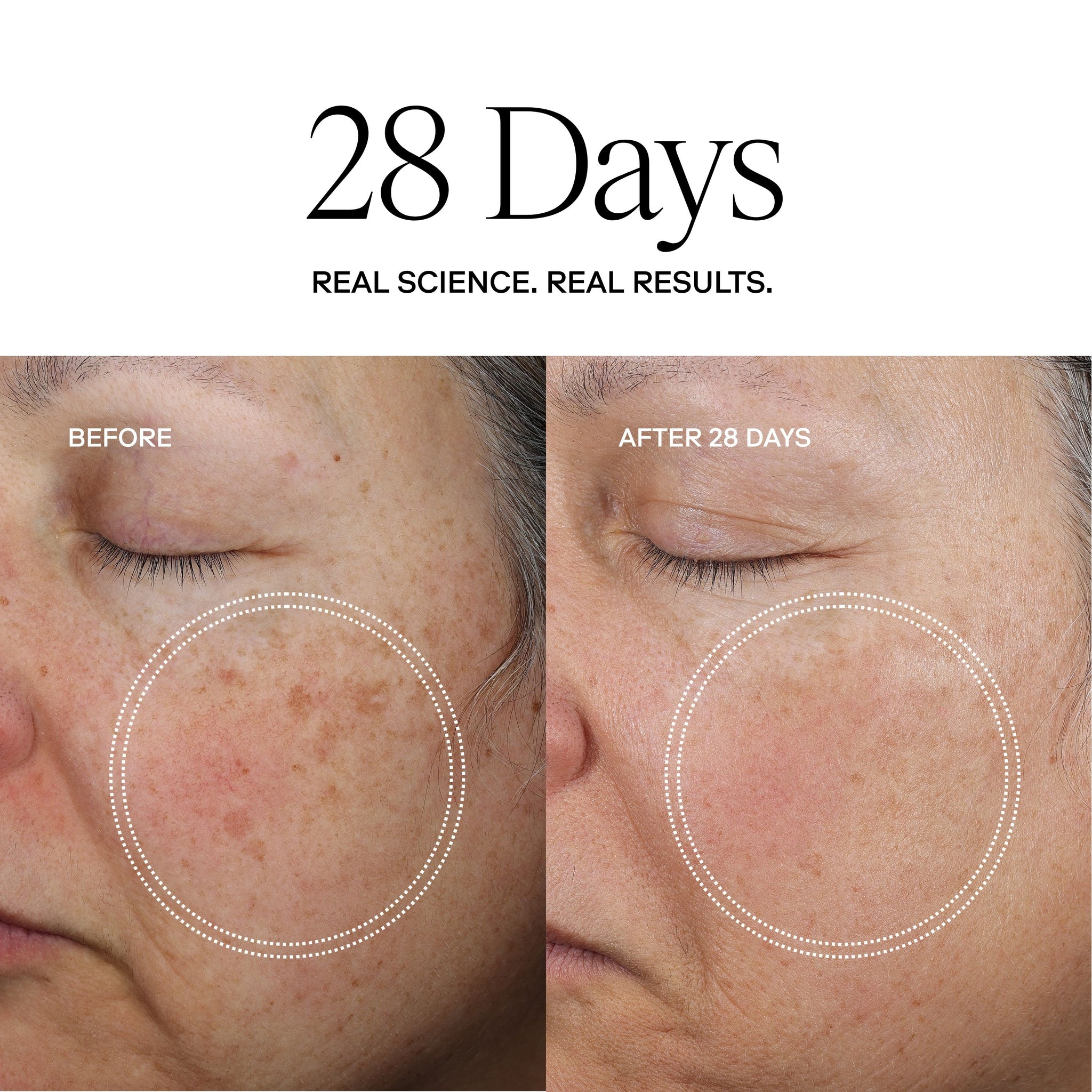 EXO FACE® Perfection Moisturizer / eXo³ Exosomes®