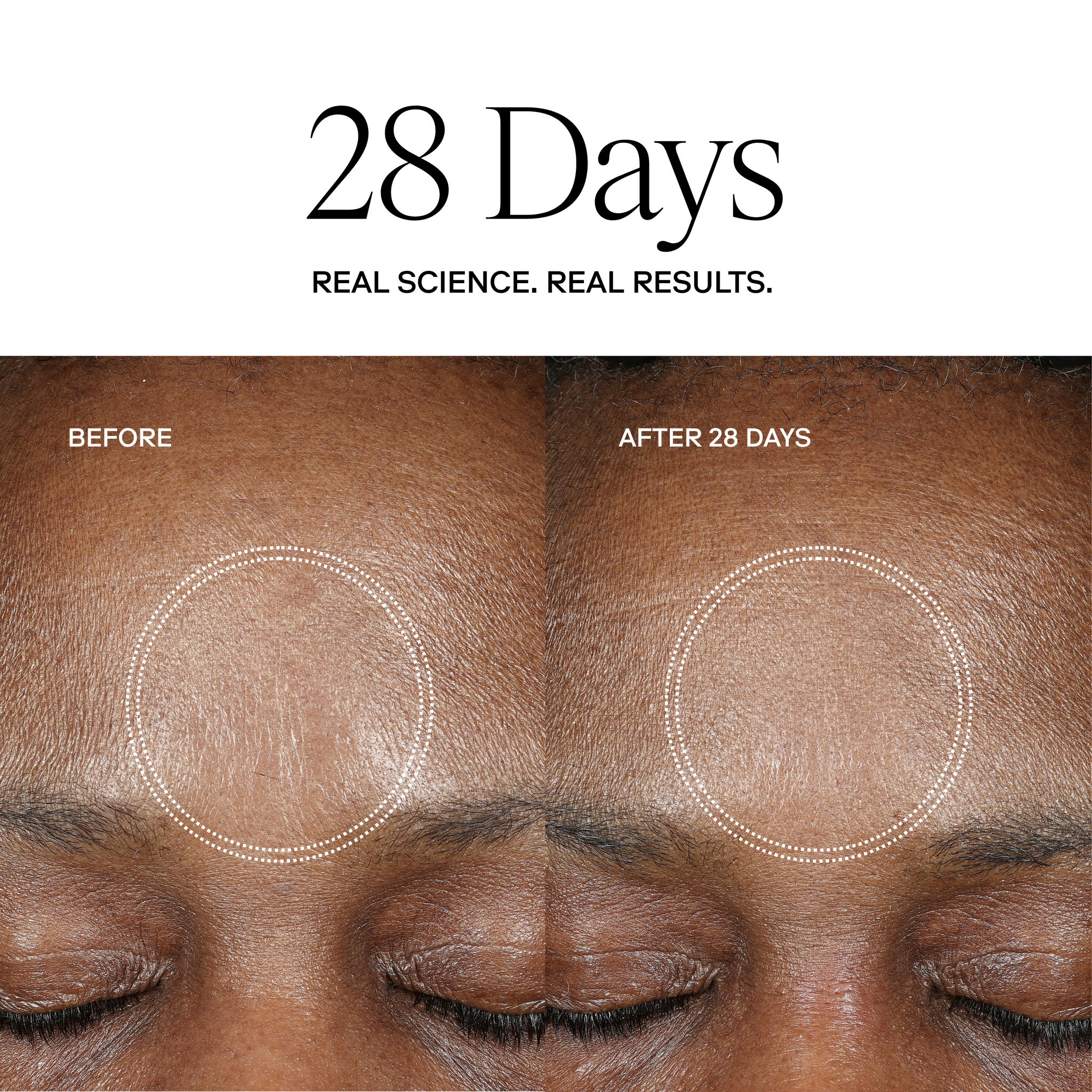 EXO H-SERUM™ Hyaluronic Acid Treatment / eXo³ Exosomes®