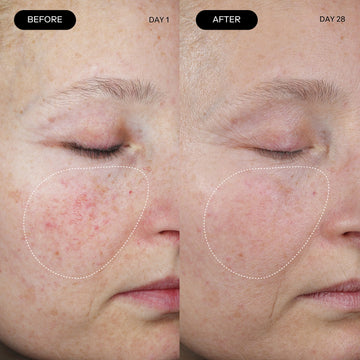 03.​ Clinically tested and proven to boost collagen, improve elasticity, and enhance overall skin health.